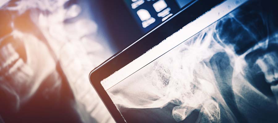 Continuing Education After MRI Technician School
