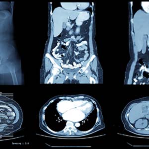Computed-Tomography-Training-for-Radiologic-Technologist