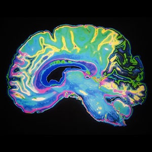 MRI-Certification-Program-for-Radiologic-Technologist