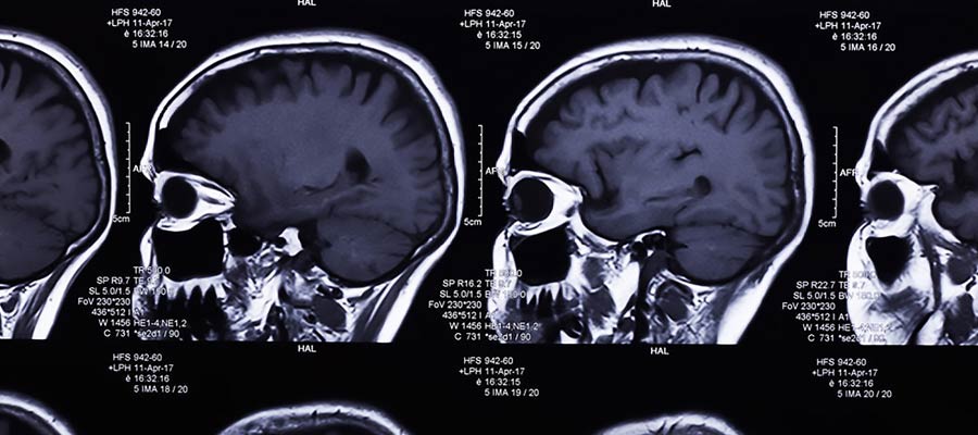 Pulse radiology technician schools