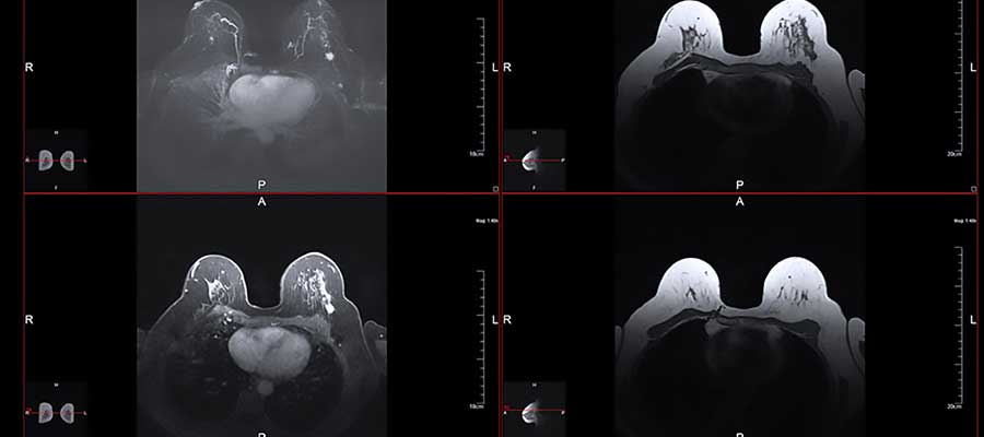 bayer mri courses available