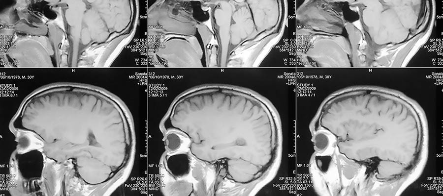 how much do mri technician make