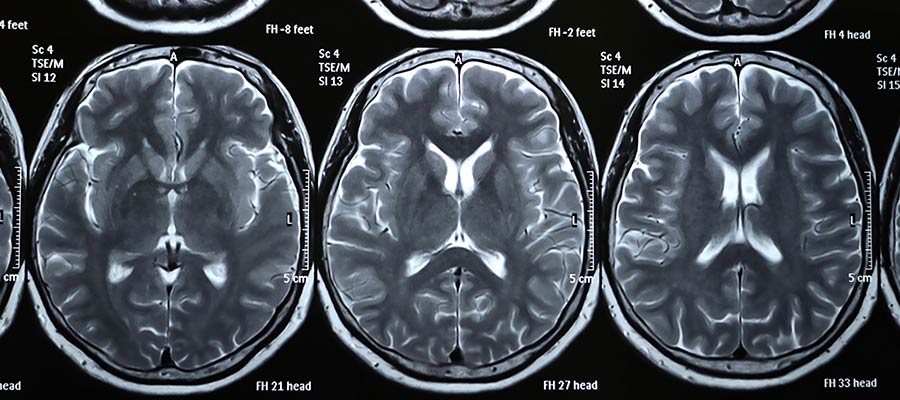 how much do radiology technician make