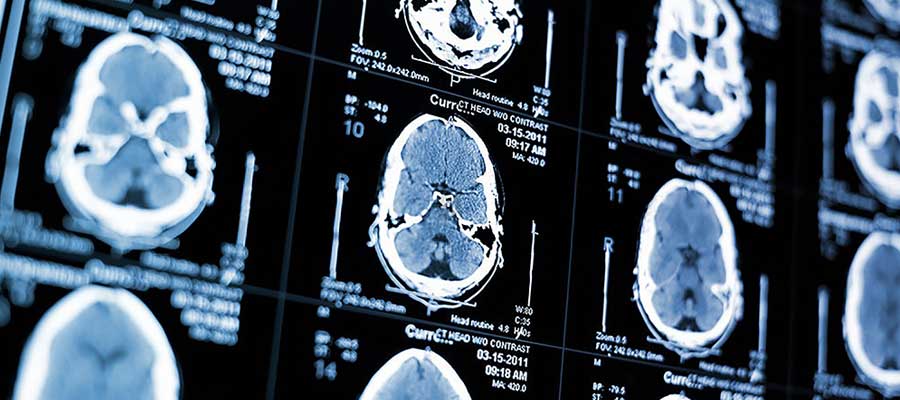 how to become an mri tech