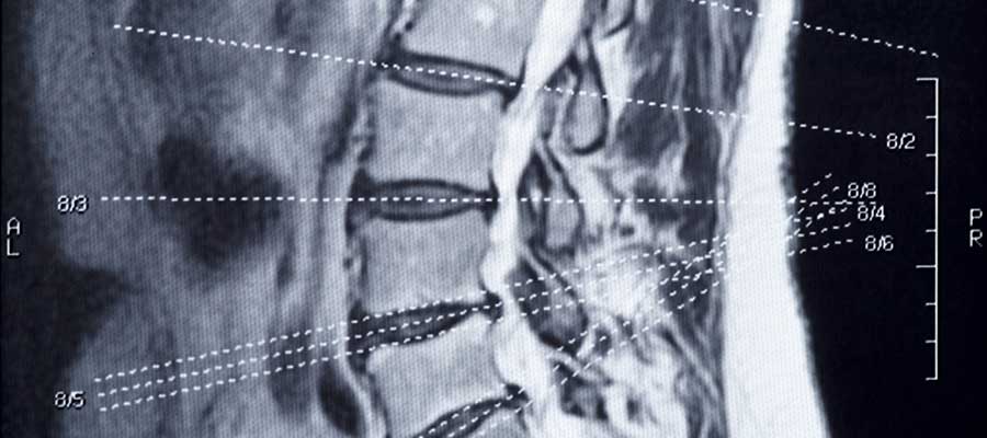 looking for breast mri courses