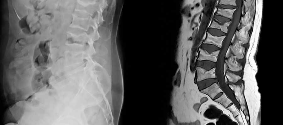 online mri courses in canada