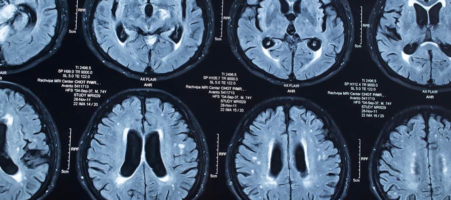 radiologic technologist school