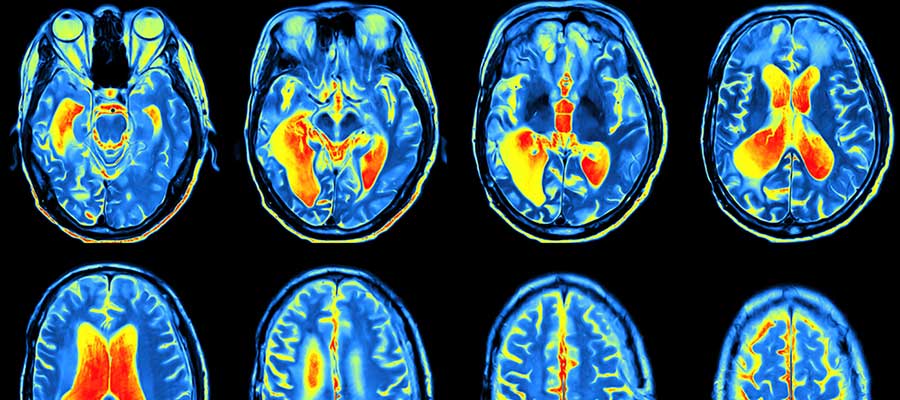 top mri courses in houston