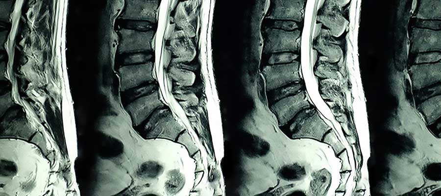 top mri courses india